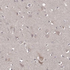 Immunohistochemical staining of human cerebral cortex shows weak cytoplasmic positivity in neurons.