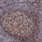 Immunohistochemical staining of human tonsil shows moderate to strong nuclear positivity in germinal center cells.