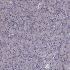 Immunohistochemical staining of human pancreas shows no positivity in exocrine glandular cells as expected.