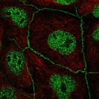 Anti-C16orf59 Antibody