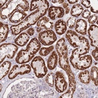 Anti-CNOT8 Antibody