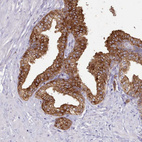 Anti-SRD5A1 Antibody