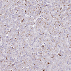 Immunohistochemical staining of human liver shows strong granular cytoplasmic positivity in Kupffer cells.