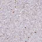 Immunohistochemical staining of human liver shows strong granular cytoplasmic positivity in Kupffer cells.