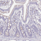 Immunohistochemical staining of human duodenum shows weak granular cytoplasmic positivity in glandular cells.