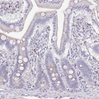 Immunohistochemical staining of human duodenum shows weak granular cytoplasmic positivity in glandular cells.