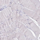 Immunohistochemical staining of human skeletal muscle shows no positivity in myocytes as expected.