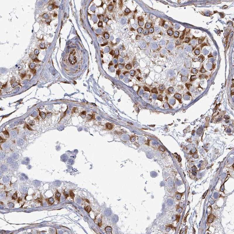 Anti-AGAP1 Antibody