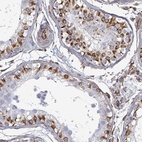 Anti-AGAP1 Antibody