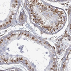 Anti-AGAP1 Antibody