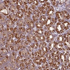 Anti-CAMK1 Antibody