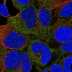 Immunofluorescent staining of human cell line HEK 293 shows localization to cytosol.