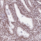 Anti-PRDM5 Antibody