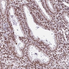 Immunohistochemical staining of human endometrium shows high expression.