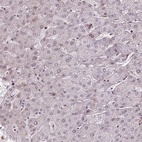 Immunohistochemical staining of human liver shows low expression as expected.