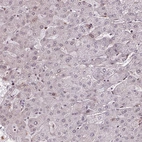 Immunohistochemical staining of human liver shows low expression as expected.
