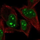 Immunofluorescent staining of human cell line RH-30 shows localization to nucleus, nucleoli & nuclear bodies.