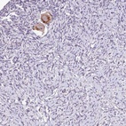 Anti-TTLL3 Antibody