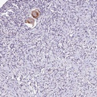 Anti-TTLL3 Antibody