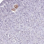 Anti-TTLL3 Antibody