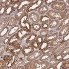Anti-THSD7B Antibody