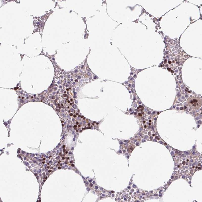 Anti-ZNF394 Antibody