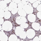 Anti-ZNF394 Antibody