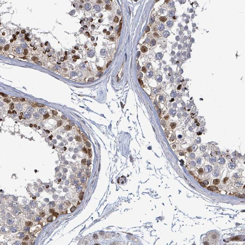 Anti-TUSC1 Antibody