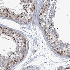 Anti-TUSC1 Antibody