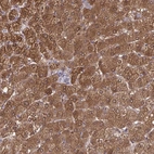 Anti-DBI Antibody
