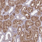 Immunohistochemical staining of human kidney shows moderate cytoplasmic positivity in cells in tubules.