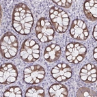 Immunohistochemical staining of human colon shows moderate cytoplasmic positivity in glandular cells.