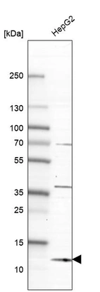 Western blot analysis in human cell line HepG2.