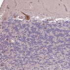 Anti-CABP1 Antibody