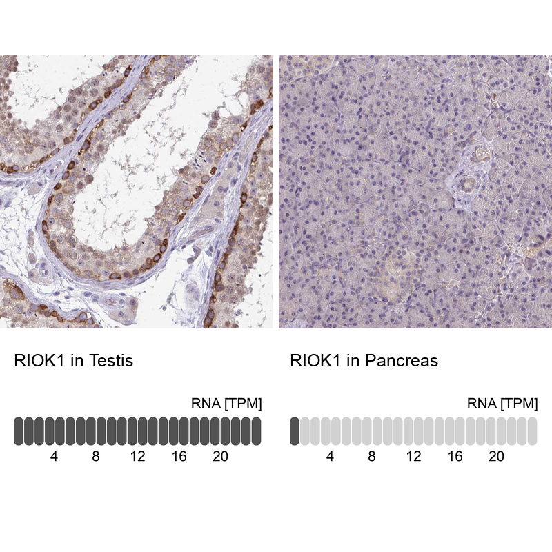 Anti-RIOK1 Antibody