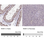 Anti-RIOK1 Antibody