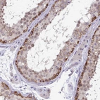 Immunohistochemical staining of human testis shows moderate cytoplasmic positivity in subset of cells in seminiferous ducts.