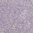 Immunohistochemical staining of human pancreas shows no cytoplasmic positivity in exocrine glandular cells as expected.