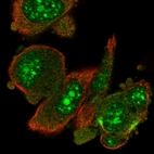 Immunofluorescent staining of human cell line PC-3 shows localization to nucleoli, nuclear speckles & cytosol.