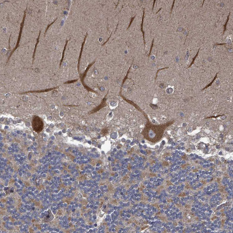 Anti-RALGAPB Antibody