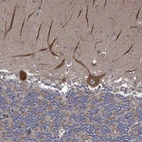 Anti-RALGAPB Antibody