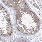 Immunohistochemical staining of human testis shows weak to moderate cytoplasmic positivity in cells in seminiferous ducts.
