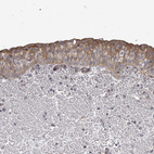 Immunohistochemical staining of human urinary bladder shows weak to moderate cytoplasmic and membranous positivity in urothelial cells.