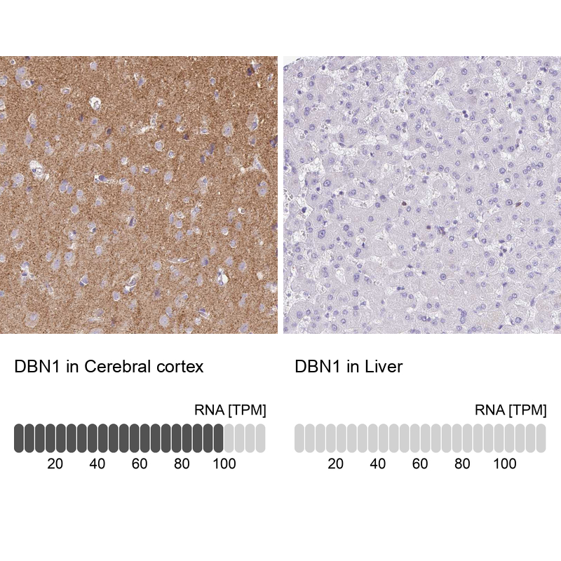 Anti-DBN1 Antibody
