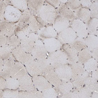 Immunohistochemical staining of human skeletal muscle shows very weak cytoplasmic and nuclear positivity in myocytes.