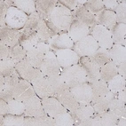 Immunohistochemical staining of human skeletal muscle shows very weak cytoplasmic and nuclear positivity in myocytes.