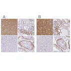 Immunohistochemical staining of human cerebral cortex, kidney, liver and testis using Anti-DBN1 antibody HPA051452 (A) shows similar protein distribution across tissues to independent antibody HPA056940 (B).