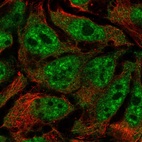 Immunofluorescent staining of human cell line CACO-2 shows localization to nuclear speckles.