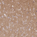 Immunohistochemical staining of human cerebral cortex shows strong positivity in neuropil.