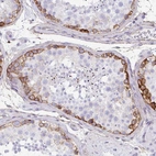 Immunohistochemical staining of human testis shows strong membranous positivity in spermatogonia.